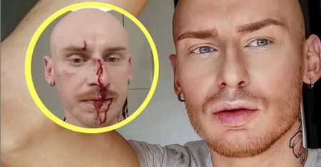 Jacek Szawioła został pobity. Sprawa trafi do prokuratury