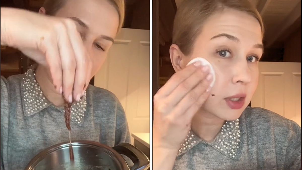 Naturalny botoks to hit kosmetyczny.