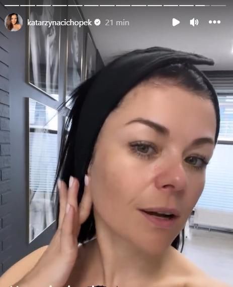 Kasia Cichopek poddała się zabiegowi?