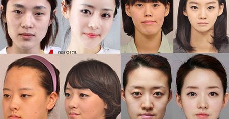KOREANKI PO OPERACJACH! Poznalibyście, że to te same osoby?! (FOTO)