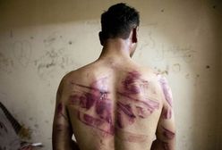 AI: Od 2011 roku w rządowych więzieniach w Syrii zginęło prawie 18 tys. osób