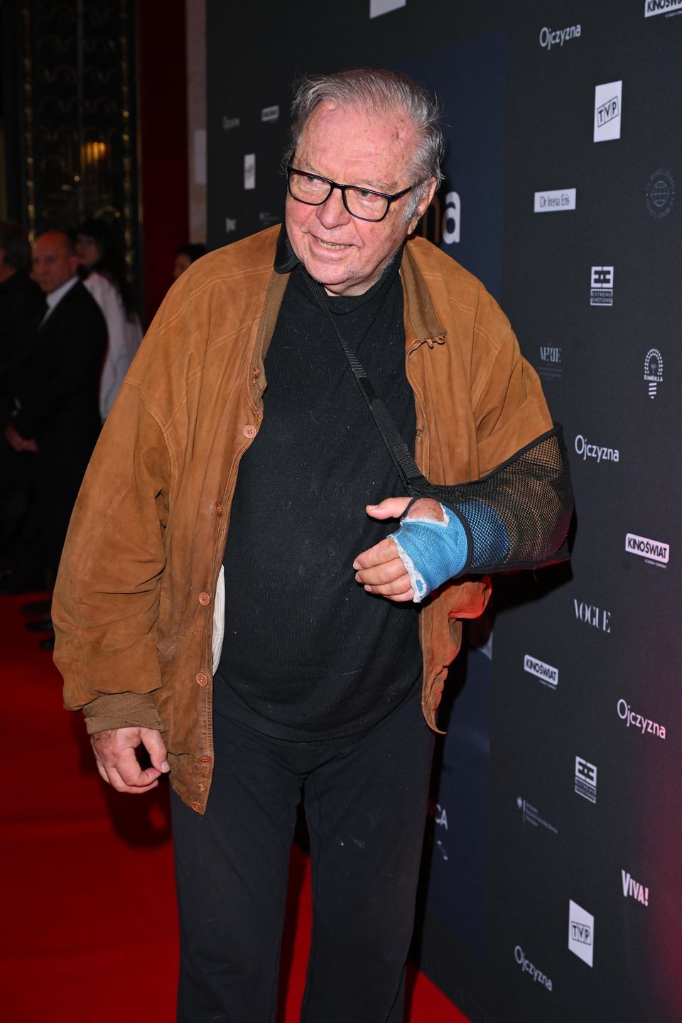 Krzysztof Zanussi złamał rękę po groźnym upadku