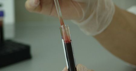 1 grudnia-światowy dzień Aids
