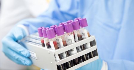 Przełom w diagnostyce alzheimera. Brytyjskie badania nad testami krwi.