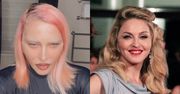 Chirurg gwiazd wymienia, jakimi zabiegami Madonna OSZPECIŁA swoją twarz w ostatnim czasie. Trochę tego było...