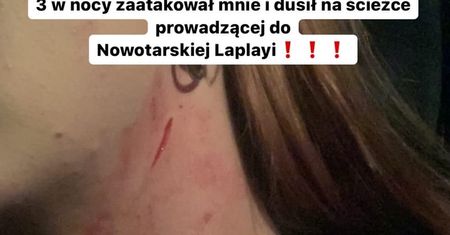 Dramatyczny apel młodej dziewczyny. "Poszukiwany facet, który mnie dusił"