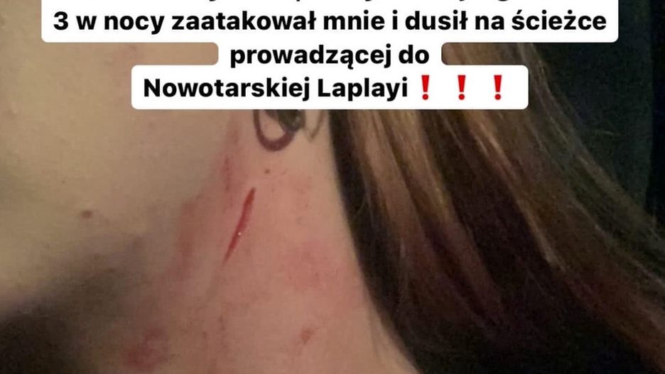 Poszukiwany sprawca napadu na młodą kobietę