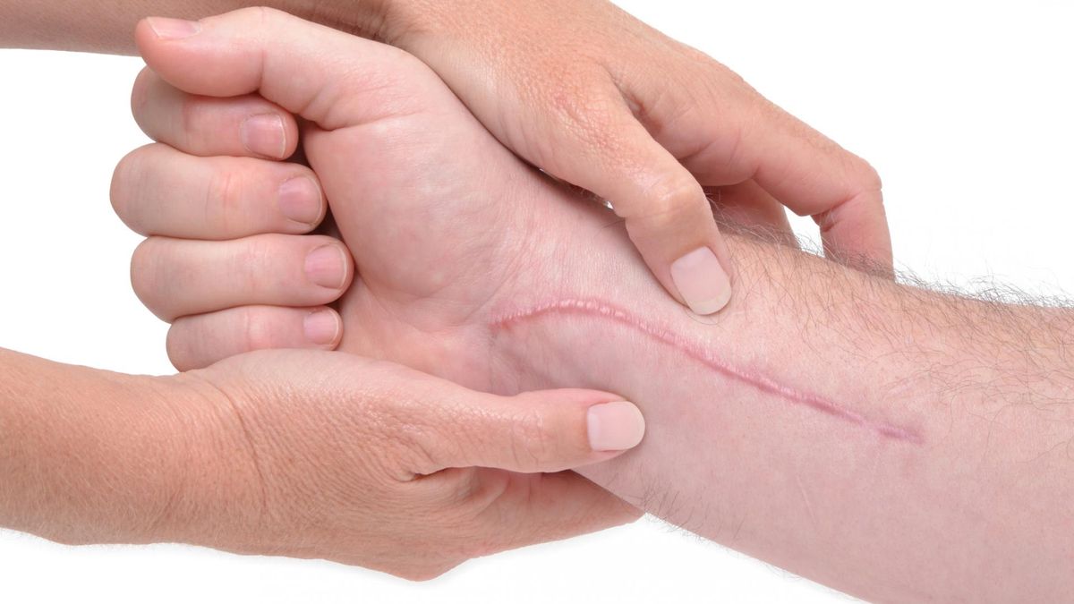 Blizny oczami fizjoterapeuty