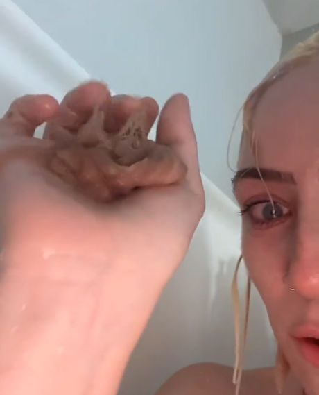 Po rozjaśnianiu włosy zaczęły wypadać garściami