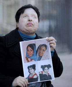 Chce by oślepiono mężczyznę, który oblał ją kwasem