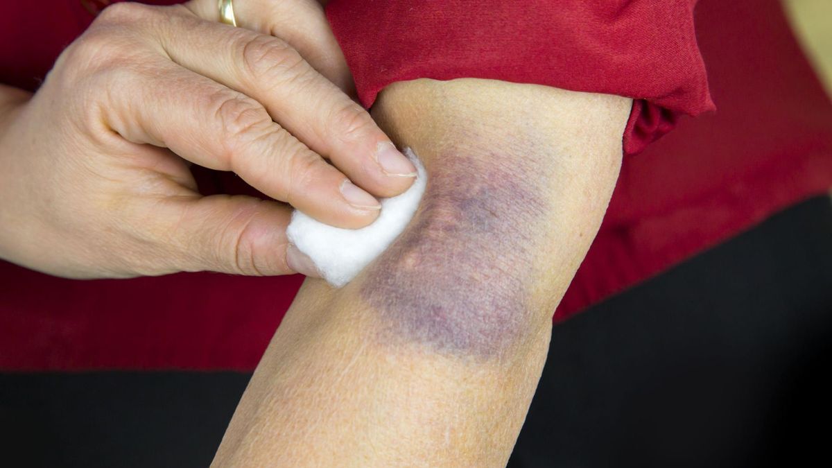 samoistne siniaki [123rf.com]