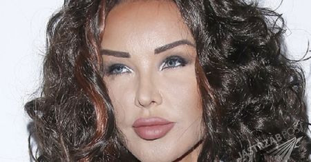 Ewa Minge obszernie wyjaśniła powody dla których pozwała chirurga plastyka