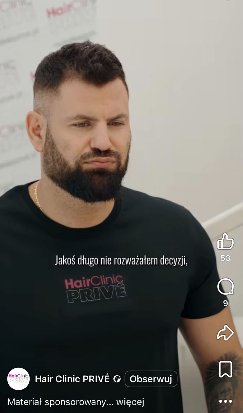 Wojtek Gola zrobił przeszczep włosów