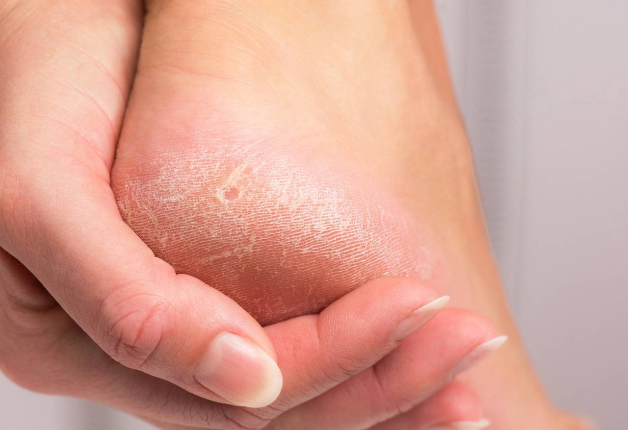 A home method to take care of your feet