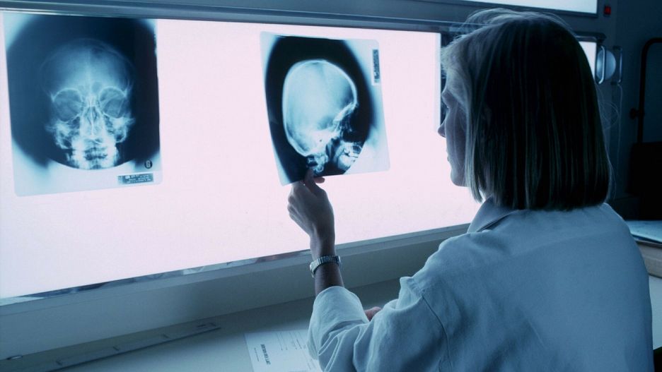 Stock picturesPHOTO: EAST NEWS/PHANIE Radiologie  Hospitalized adultRAGUET