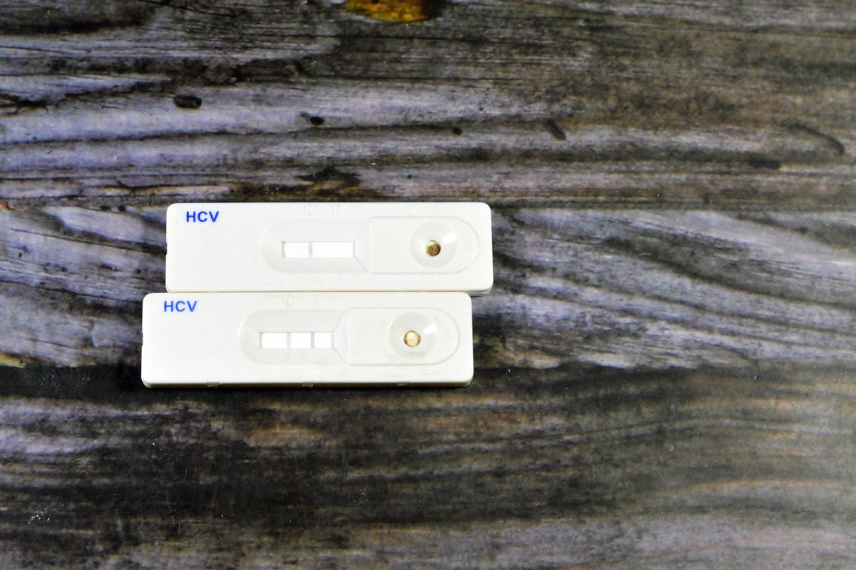 W Polsce brakuje programu badań przesiewowych w kierunku HCV