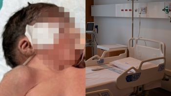 Noworodek w Indiach urodził się z DWIEMA GŁOWAMI. Trwa walka o jego życie