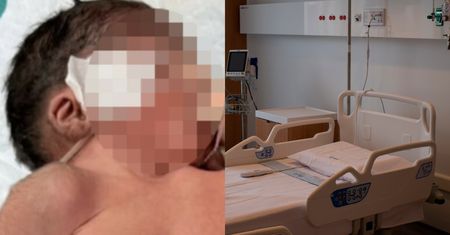 Noworodek w Indiach urodził się z DWIEMA GŁOWAMI. Trwa walka o jego życie