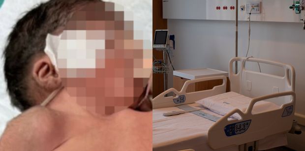 Noworodek w Indiach urodził się z DWIEMA GŁOWAMI. Trwa walka o jego życie