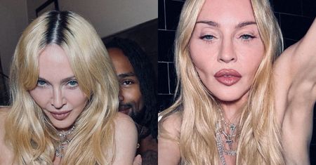 Odmieniona Madonna pozuje TOPLESS. Fani ostro: "Wygląda jak karykatura samej siebie" (ZDJĘCIA)