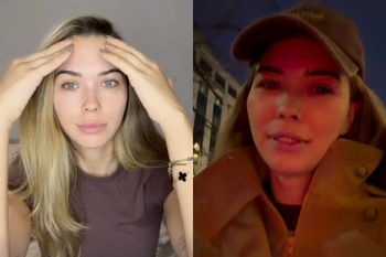 Lekarz odmówił Sandrze Kubickiej zabiegu przez BOTOKS. Nie mogła milczeć w tej sprawie