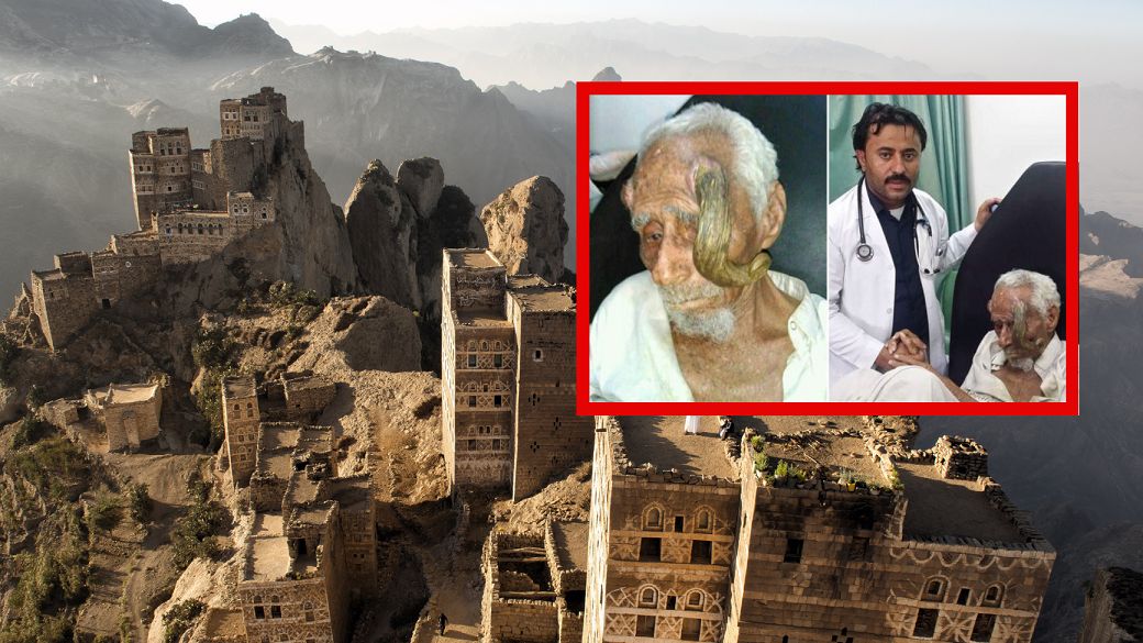 Na głowie mężczyzny wyrosły rogi. Zdecydował się na ich usunięcie