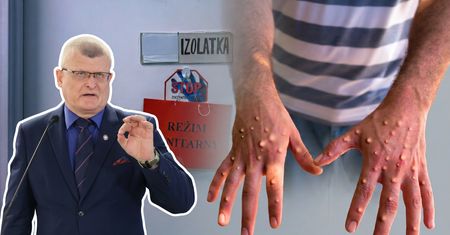 Ponad dwa razy więcej chorych na mpox. "Wirus nie wygasł"