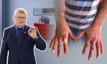 Ponad dwa razy więcej chorych na mpox. "Wirus nie wygasł"