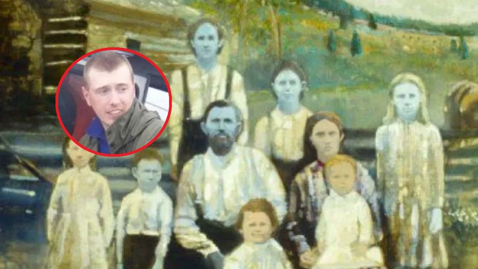 Chłopiec przyszeł na świat z niebieską skórą. Lekarzowi udało się odkryć zaskakującą przyczynę