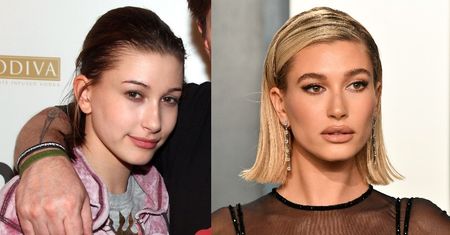 Bieberowie chcą POZWAĆ lekarza, który zasugerował, że Hailey poddała się serii operacji plastycznych!