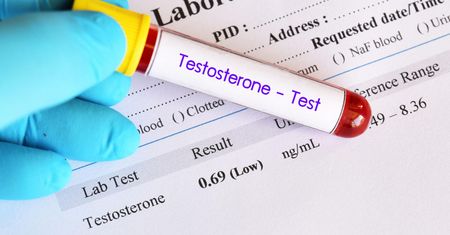 Testosteron - rola, badanie, nadmiar, niedobór