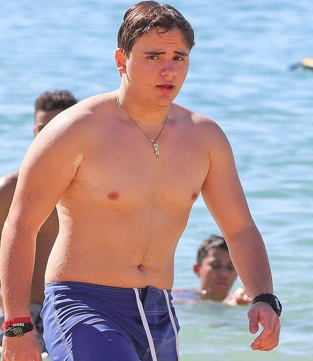 Prince Jackson też cierpi na bielactwo?!