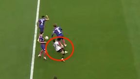 Dramatyczna kontuzja. Boli od samego patrzenia