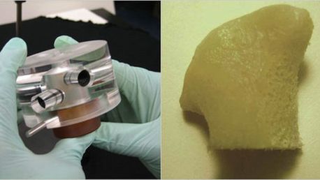 Hodowla ludzkich kości z komórek macierzystych 1