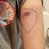 Dziewczynkę drapała metka. Matka była przerażona, gdy zdjęła koszulkę
