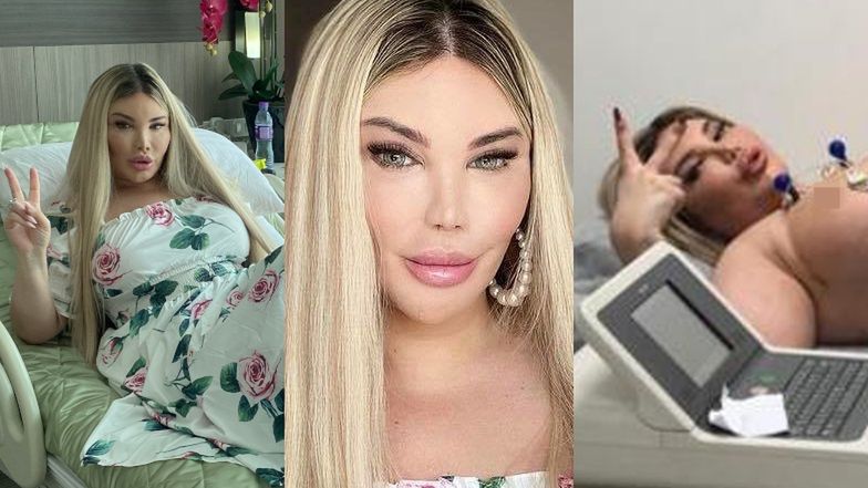 Jessica Alves przeszła operację korekty płci