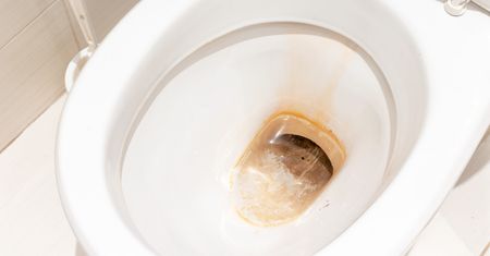 Kamień w toalecie zniknie bez szorowania. Wystarczy prosty trik