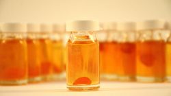 Dolegliwość co czwartej Polki. Ginekolog wyjaśnia