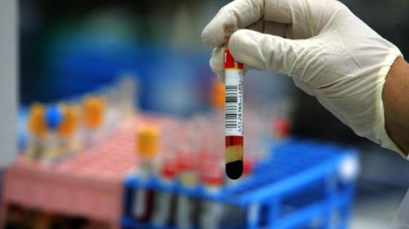 Prawidłowe stężenie chlorków we krwi powinno wynosić  95 do 105 mmol/l.