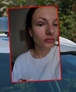 Zsiadł z roweru i pięścią uderzył kobietę. Brutalny atak w Warszawie