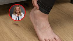 Lekarka wskazuje, które choroby "lubią objawiać się na stopach". To nie tylko cukrzyca