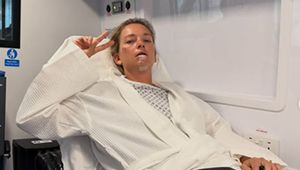 Koszmar gwiazdy tenisa na Wimbledonie. Straciła dwa zęby
