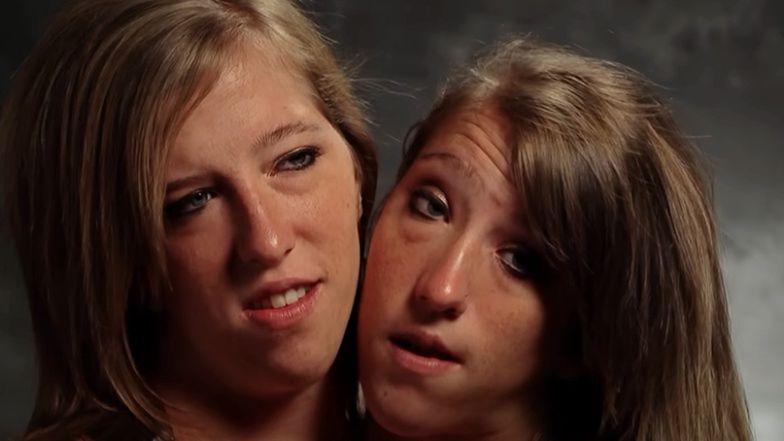 jak słynne bliźniaczki prowadzą AUTO, jedzą i uprawiają seks?