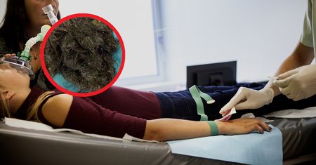 Lekarze nie mogli uwierzyć. Oto co wyciągnęli z brzucha 14-latki