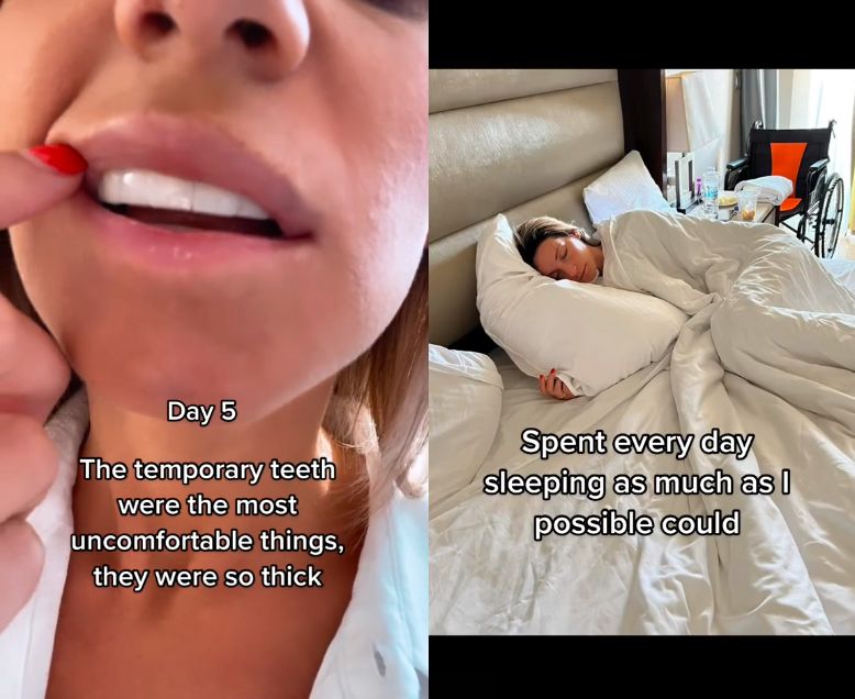 Turecka metamorfoza z piekła rodem