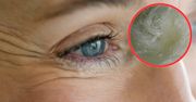 Kosztuje tylko 10 zł. Wklep wokół oczu, a zmarszczki zaczną się wygładzać