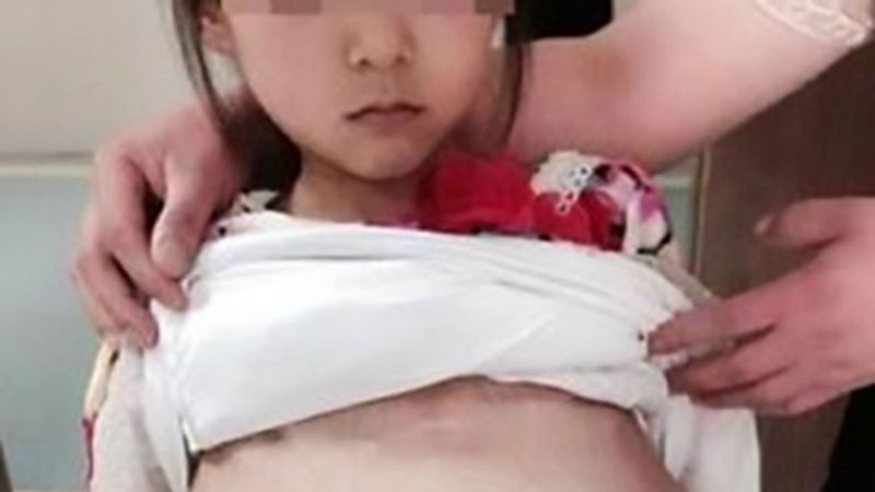 12-latka z Chin w ciąży z 40-latkiem