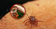 Kleszcze coraz częściej pojawiają się w ogrodzie. Jak chronić się przed ukąszeniem?