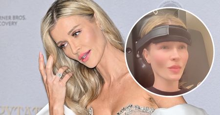 Joanna Krupa mierzy się z problemami zdrowotnymi. Wszystkiemu winny STRES