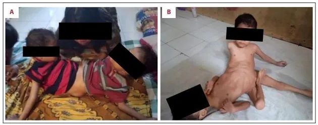 Zabieg umożliwił podnoszenie tułowia